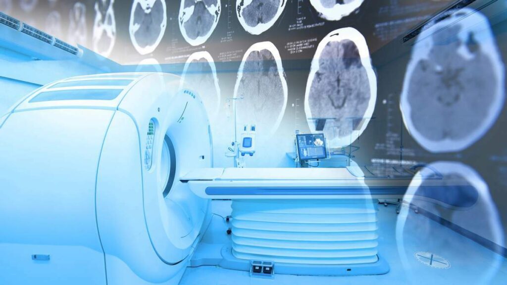 Компьютерная томография: диагностическое значение