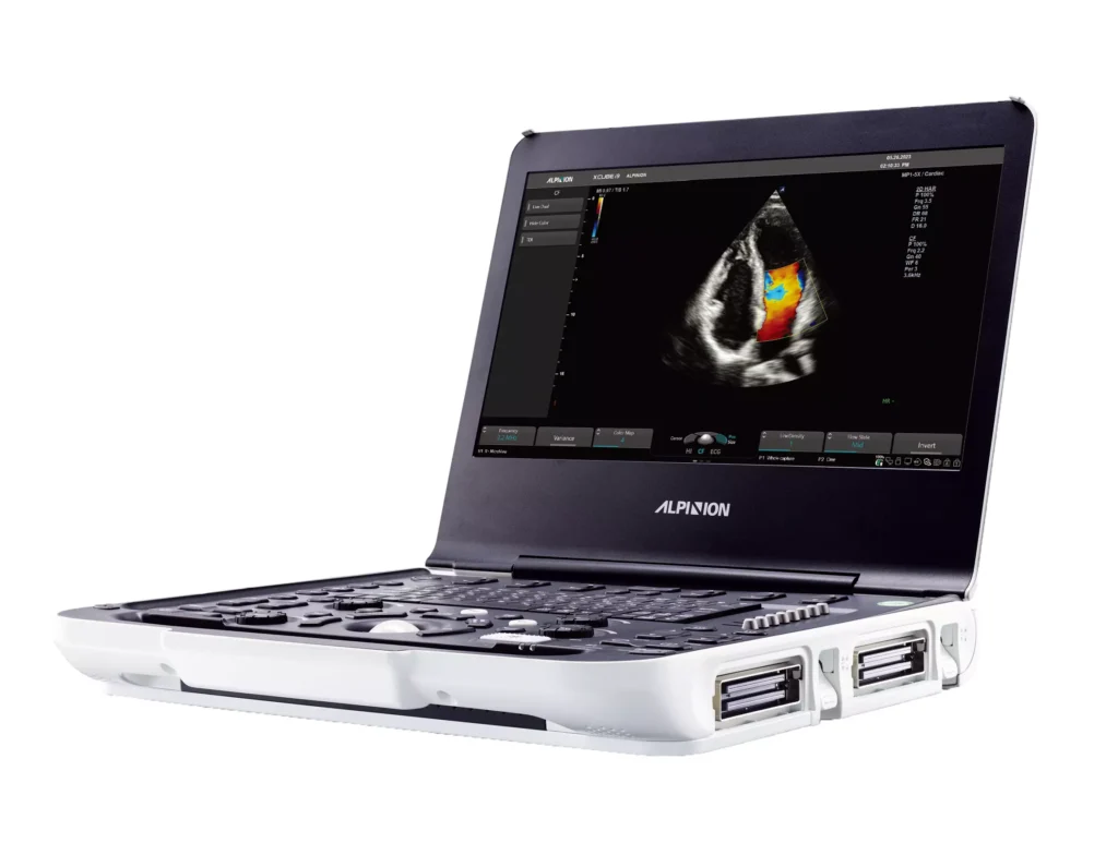 Портативні УЗД-апарати: переваги та особливості