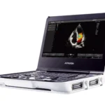 Портативні УЗД-апарати: переваги та особливості