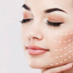 Круговая подтяжка лица в Grace Clinic — верните молодость и уверенность