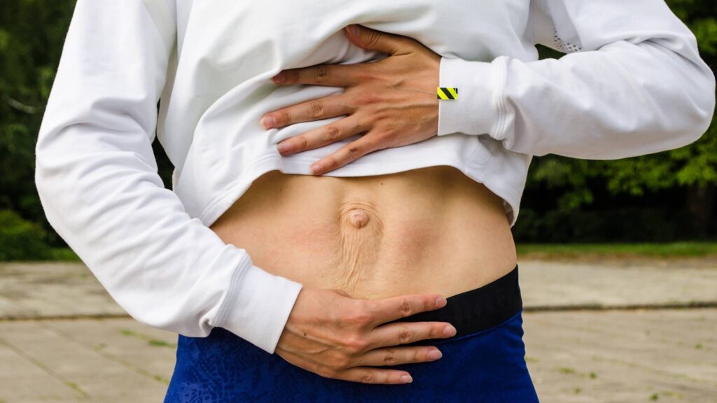 Диастаз прямых мышц живота: причины, симптомы и методы лечения