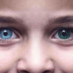 Что такое гетерохромия: определение, причины и основные формы