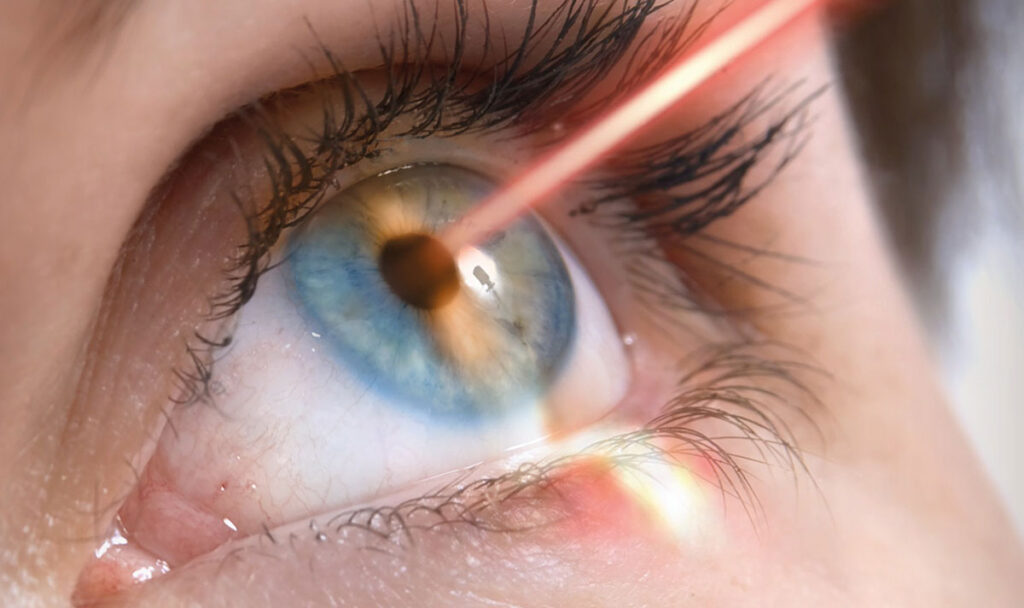 Клапоть чи поверхня: як в «Ексімер» обирають між Femto LASIK і безконтактними методиками